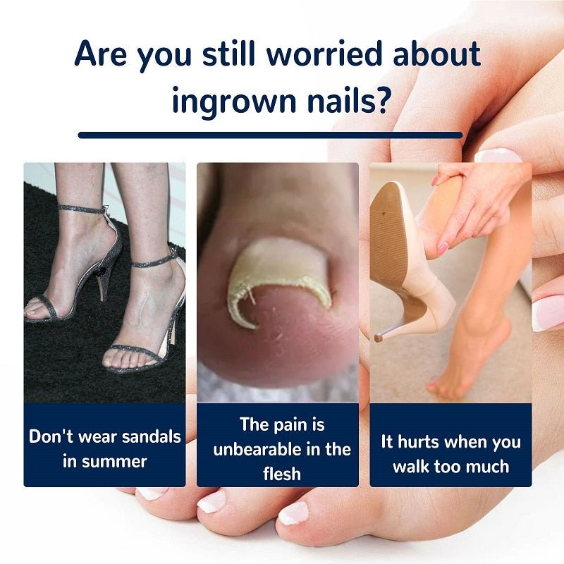 Ingrown Nail Corrector - LightsBetter