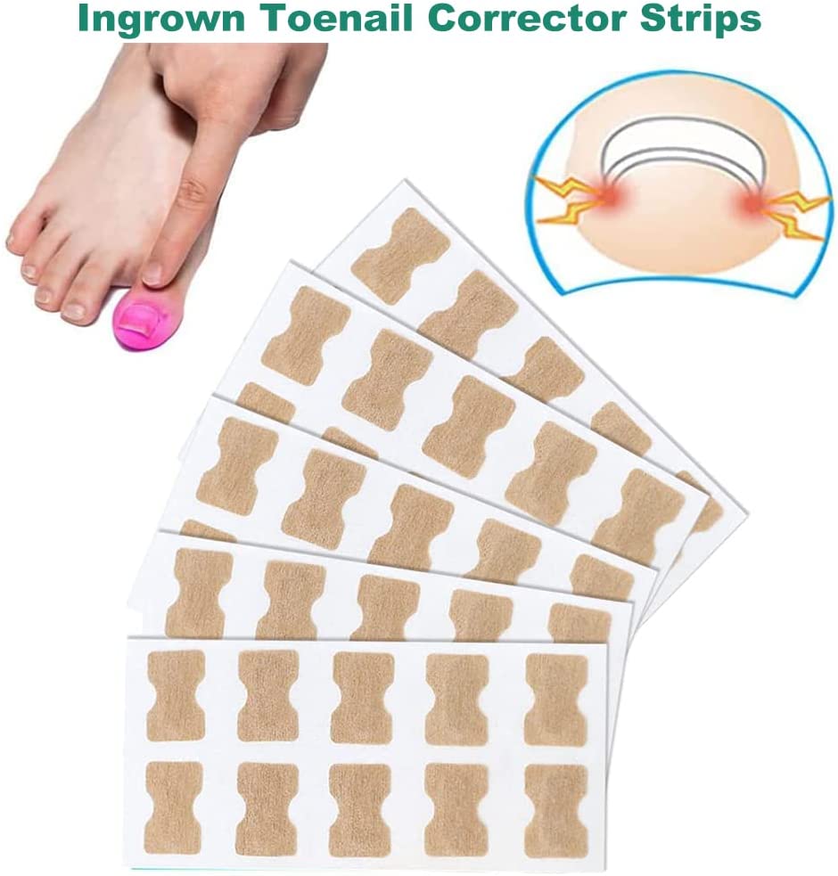 Ingrown Nail Corrector - LightsBetter