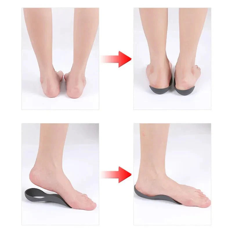 Orthopaedic Insoles - LightsBetter