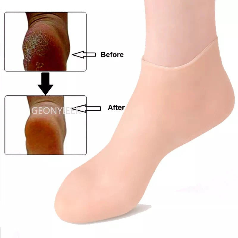 Silicone Feet Care Socks - LightsBetter