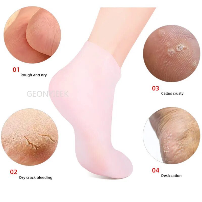 Silicone Feet Care Socks - LightsBetter